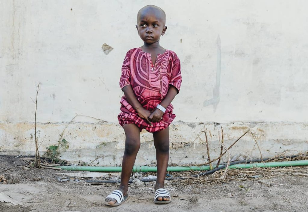 Amadou - Globals Mercys første patient